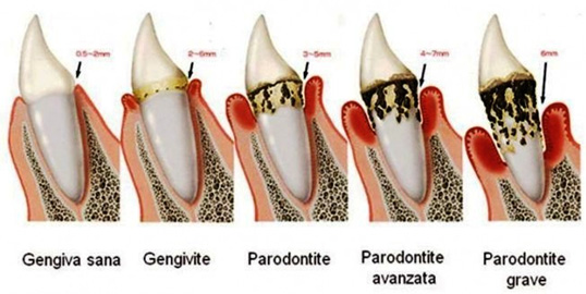 igieneorale